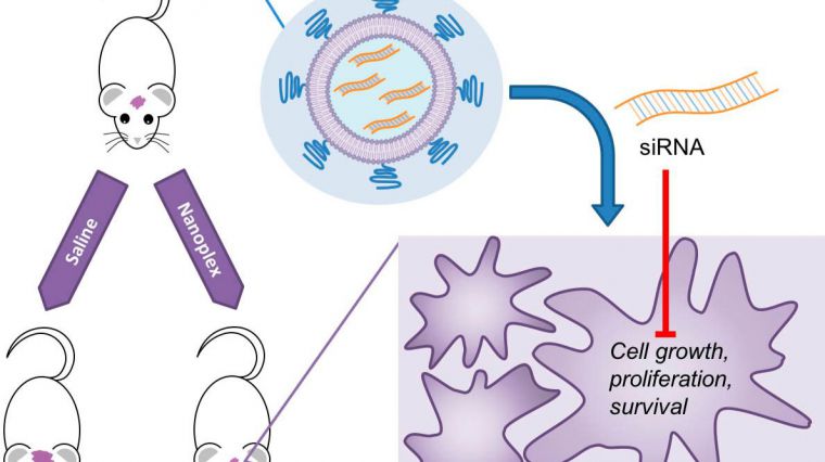 Terapia génica con nanopartículas para combatir tumores cerebrales muy agresivos