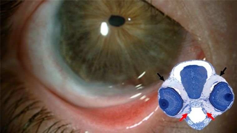 La UCLM coordina una investigación que facilita el diagnóstico y ayuda a conocer mejor las causas del glaucoma congénito