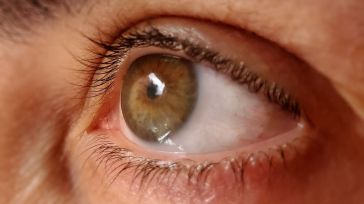 Unos 45.000 castellano-manchegos padecen Glaucoma y aproximadamente la mitad no lo saben 