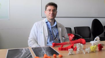 El Hospital de Ciudad Real incorpora la impresión 3D para planificar las intervenciones en traumatología