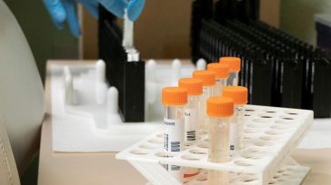 Sanidad notifica un nuevo caso de viruela del mono en CLM en la última semana semana