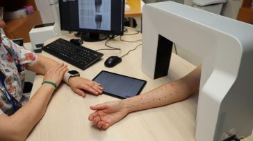 El Hospital Universitario de Toledo incorpora una nueva herramienta digital para la lectura de las pruebas cutáneas del servicio de Alergología