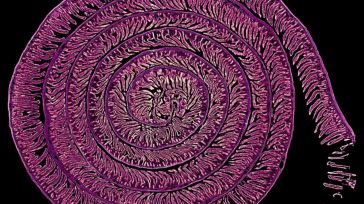 Una fotografía realizada en el Hospital Nacional de Parapléjicos, galardonada en la modalidad Micro de Fotciencia21