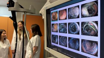 El Hospital General de Almansa, a la vanguardia en la detección precoz de lesiones digestivas mediante cromoendoscopia